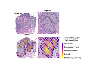 Darstellung der Differenzierung der Talgdrüsenzellen anhand von räumlicher Transkriptomuntersuchung. Obere Zeile: Histologische Struktur der untersuchten Talgdrüsen (Hämatoxylin-Eosin-Färbung). Der Bereich im weißen Rechteck ist rechts vergrößert. Untere Zeile: Die aus der molekulabiologischen und bioinformatischen Analyse generierten Cluster (bunte Kreise; links und Mitte) bilden die spezifische Genexpression in diesem Bereich ab. Sie wurden auf dem Originalgewebe übertragen und stellen die kontinuierliche Entwicklung der Talgdrüsenzellen durch konsekutive Modulation zellulärer Funktionen dar (rechts).