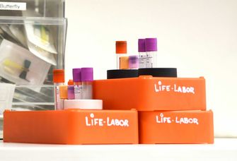 Proben im Labor des Leipziger Forschungszentrums für Zivilisationserkrankungen (LIFE). Foto: Anton Stolle 